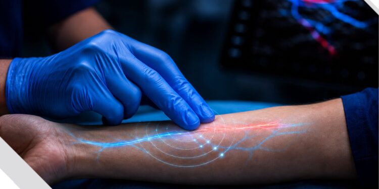 Venezolano desarrolla tecnología médica que podría transformar el acceso vascular